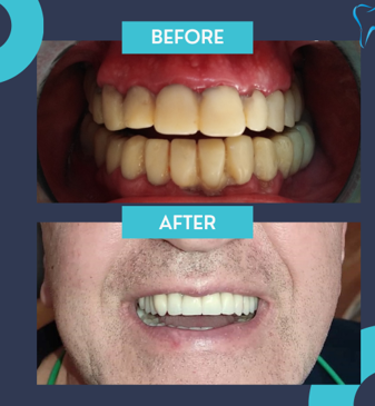 Slider image (6) Dr. Aleksandar Kovacevic - Dental Clinic in Croatia